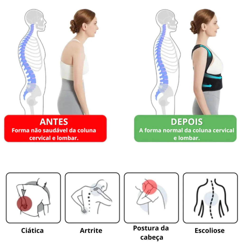 Corretor Postural Ortopédico Premium - Unissex