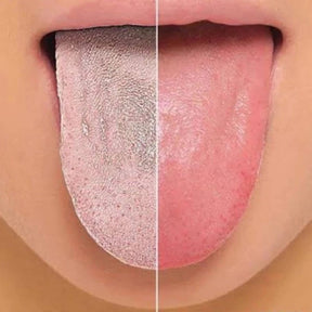 Raspador de Língua Removedor de Bactérias em Aço Inoxidável - Compre 1 Leve 3