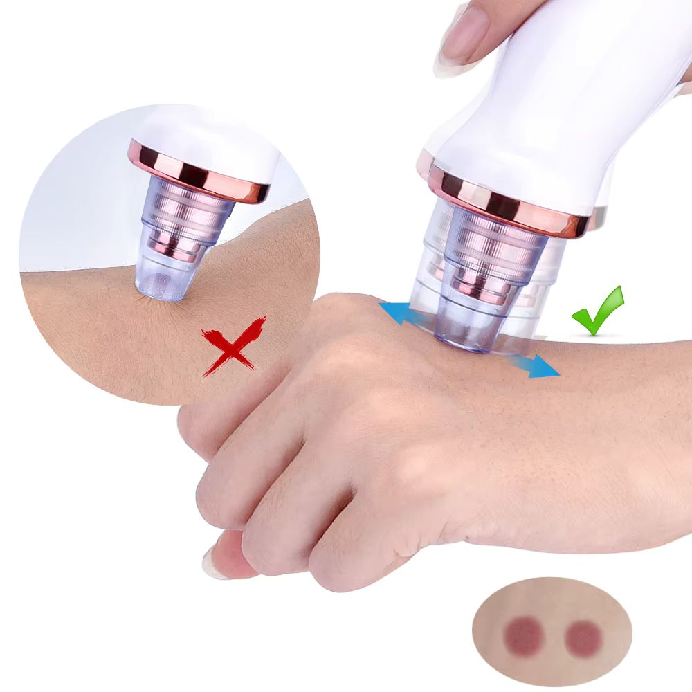 Removedor Elétrico de Cravos e Espinhas A Vácuo Recarregável